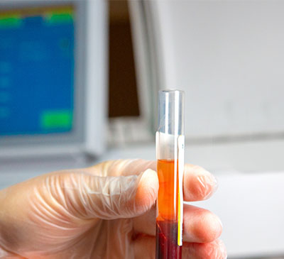 Point-of-Care Coagulation Testing Market by End-user and Geography - Forecast and Analysis 2021-2025